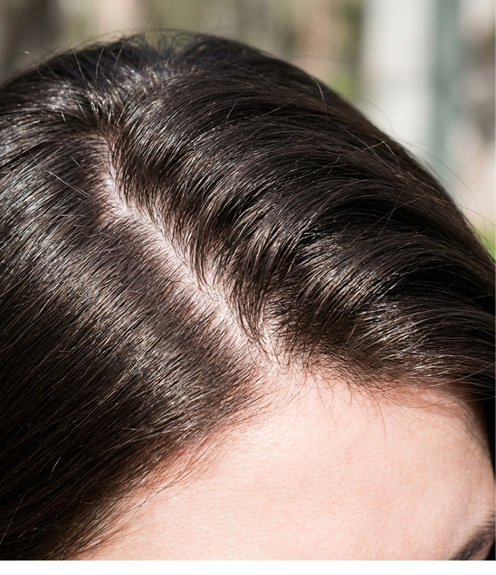 Hair Treatment
